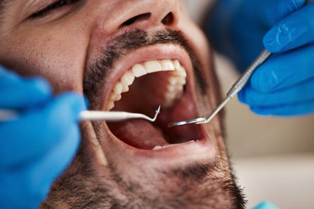 Best Holiday Emergency Dentist in Healdton, OK